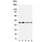 Angiopoietin 2 antibody, R30172, NSJ Bioreagents, Western Blot image 