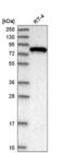 Exocyst Complex Component 3 antibody, NBP2-55179, Novus Biologicals, Western Blot image 