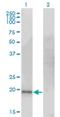 Cysteine Dioxygenase Type 1 antibody, H00001036-M09, Novus Biologicals, Western Blot image 