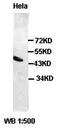 SMAD Family Member 7 antibody, orb77441, Biorbyt, Western Blot image 