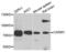 Coactivator Associated Arginine Methyltransferase 1 antibody, LS-C332011, Lifespan Biosciences, Western Blot image 