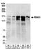 PRR8 antibody, A303-927A, Bethyl Labs, Western Blot image 