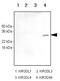 Killer Cell Immunoglobulin Like Receptor, Two Ig Domains And Short Cytoplasmic Tail 4 antibody, GTX50069, GeneTex, Western Blot image 