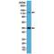 Nuclear Factor Kappa B Subunit 1 antibody, M00283-1, Boster Biological Technology, Western Blot image 