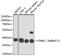 Transmembrane Protein 173 antibody, GTX33549, GeneTex, Western Blot image 