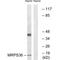 Mitochondrial Ribosomal Protein S36 antibody, A14893, Boster Biological Technology, Western Blot image 
