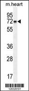 Coiled-Coil Domain Containing 148 antibody, 55-286, ProSci, Western Blot image 