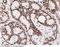 Protein Kinase, DNA-Activated, Catalytic Subunit antibody, 101038-T10, Sino Biological, Immunohistochemistry paraffin image 
