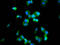 Codanin 1 antibody, LS-C680256, Lifespan Biosciences, Immunofluorescence image 