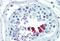 Cyclin D1 antibody, MBS242546, MyBioSource, Immunohistochemistry paraffin image 