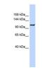 ATPase Plasma Membrane Ca2+ Transporting 4 antibody, NBP1-59481, Novus Biologicals, Western Blot image 