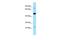 Thromboxane A Synthase 1 antibody, PA5-45676, Invitrogen Antibodies, Western Blot image 