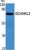 Doublecortin Like Kinase 3 antibody, A15882, Boster Biological Technology, Western Blot image 