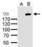 Roundabout Guidance Receptor 1 antibody, PA5-34931, Invitrogen Antibodies, Western Blot image 