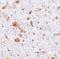 Thymic Stromal Lymphopoietin antibody, A01096-4, Boster Biological Technology, Immunohistochemistry paraffin image 