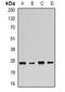 Fibroblast Growth Factor 14 antibody, orb378056, Biorbyt, Western Blot image 