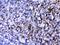 CD2 Molecule antibody, PA5-78966, Invitrogen Antibodies, Immunohistochemistry paraffin image 