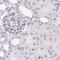 Synaptoporin antibody, PA5-62391, Invitrogen Antibodies, Immunohistochemistry paraffin image 