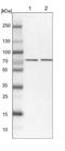 Threonyl-TRNA Synthetase 2, Mitochondrial antibody, NBP1-82294, Novus Biologicals, Western Blot image 