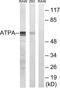 ATP Synthase F1 Subunit Alpha antibody, LS-B5741, Lifespan Biosciences, Western Blot image 