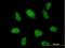 Tripartite Motif Containing 62 antibody, H00055223-B01P, Novus Biologicals, Immunofluorescence image 