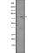 Phosphoinositide-3-Kinase Regulatory Subunit 2 antibody, abx217773, Abbexa, Western Blot image 