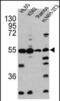 Caspase 2 antibody, PA5-11407, Invitrogen Antibodies, Western Blot image 