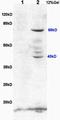 Potassium Voltage-Gated Channel Subfamily A Member 7 antibody, orb6265, Biorbyt, Western Blot image 