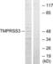 Transmembrane Serine Protease 3 antibody, LS-B9928, Lifespan Biosciences, Western Blot image 