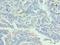 Enhancer Of Zeste 1 Polycomb Repressive Complex 2 Subunit antibody, LS-C378991, Lifespan Biosciences, Immunohistochemistry frozen image 