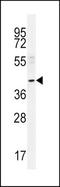 Cytosolic sialidase antibody, TA324482, Origene, Western Blot image 