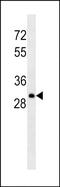 Immunoglobulin Lambda Constant 1 antibody, MA5-24718, Invitrogen Antibodies, Western Blot image 