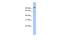 Transmembrane Serine Protease 6 antibody, A02093, Boster Biological Technology, Western Blot image 