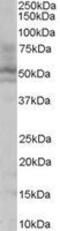 Hepatocyte Nuclear Factor 4 Alpha antibody, GTX89532, GeneTex, Western Blot image 