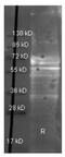 Fibrinogen Alpha Chain antibody, NBP2-50087, Novus Biologicals, Western Blot image 