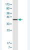 Trafficking Kinesin Protein 1 antibody, H00022906-M01A-200ul, Novus Biologicals, Western Blot image 