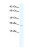 Transcription factor 23 antibody, NBP1-91533, Novus Biologicals, Western Blot image 