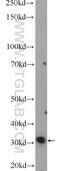 Malate Dehydrogenase 2 antibody, 15462-1-AP, Proteintech Group, Western Blot image 