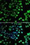 N-Terminal Xaa-Pro-Lys N-Methyltransferase 1 antibody, PA5-77131, Invitrogen Antibodies, Immunofluorescence image 