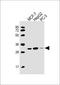 Proteasome Activator Subunit 2 antibody, 62-406, ProSci, Western Blot image 