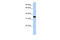 Lactate Dehydrogenase A antibody, 26-925, ProSci, Enzyme Linked Immunosorbent Assay image 