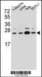 Signal Sequence Receptor Subunit 2 antibody, MBS9213824, MyBioSource, Western Blot image 