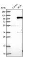 Interferon Gamma Inducible Protein 16 antibody, NBP1-83118, Novus Biologicals, Western Blot image 