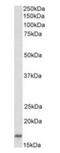 CD83 Molecule antibody, orb377875, Biorbyt, Western Blot image 