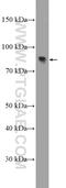 Zinc Finger Protein 600 antibody, 20100-1-AP, Proteintech Group, Western Blot image 