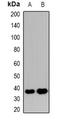 SLC9A3 Regulator 2 antibody, orb382579, Biorbyt, Western Blot image 