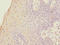 Forkhead Box P1 antibody, LS-C317913, Lifespan Biosciences, Immunohistochemistry paraffin image 