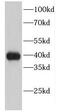 Eukaryotic Translation Initiation Factor 2B Subunit Beta antibody, FNab02694, FineTest, Western Blot image 