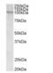 Vav Guanine Nucleotide Exchange Factor 3 antibody, NB300-817, Novus Biologicals, Western Blot image 