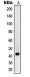 Sarcoglycan Beta antibody, MBS821819, MyBioSource, Western Blot image 